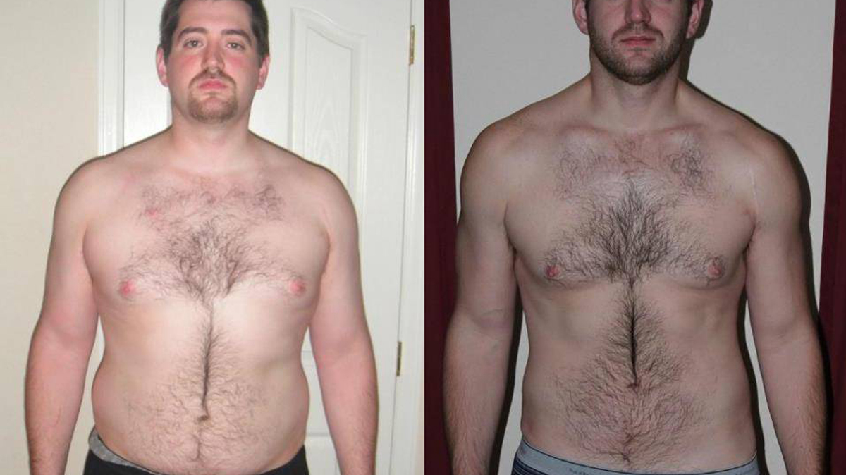 Мужчина после. Male body hair places. Discolored body hair. Reddit should men grow there hair.